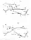 Fig. 14 - Method of preparing an acetabulum for receiving a head of a femoral prosthesis