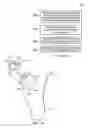 Fig. 16 - Method of preparing an acetabulum for receiving a head of a femoral prosthesis