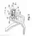 Fig. 03 - Spinal distraction and endplate preparation device and method