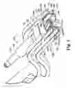 Fig. 04 - Spinal distraction and endplate preparation device and method