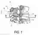 Fig. 02 - METHODS FOR SENSING RETROGRADE FLOWS OF BONE FILL MATERIAL