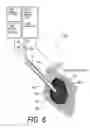 Fig. 08 - METHODS FOR SENSING RETROGRADE FLOWS OF BONE FILL MATERIAL