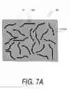 Fig. 09 - METHODS FOR SENSING RETROGRADE FLOWS OF BONE FILL MATERIAL