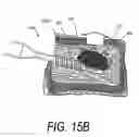 Fig. 22 - METHODS FOR SENSING RETROGRADE FLOWS OF BONE FILL MATERIAL