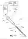 Fig. 28 - METHODS FOR SENSING RETROGRADE FLOWS OF BONE FILL MATERIAL