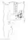 Fig. 02 - Curve linear and straight mandibular distractor with occlusion correction feature