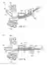 Fig. 03 - Curve linear and straight mandibular distractor with occlusion correction feature