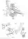 Fig. 04 - Curve linear and straight mandibular distractor with occlusion correction feature
