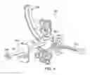 Fig. 06 - Curve linear and straight mandibular distractor with occlusion correction feature