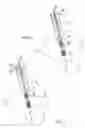 Fig. 05 - Method and apparatus for retaining a guide wire