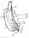 Fig. 01 - Apparatus and method for colonoscopic appendectomy