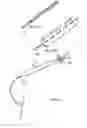 Fig. 10 - Apparatus and method for colonoscopic appendectomy