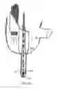 Fig. 24 - Apparatus and method for colonoscopic appendectomy