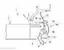 Fig. 01 - Loading device for indwelling implement