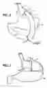 Fig. 04 - Methods and devices for maintaining a space occupying device in a relatively fixed location within a stomach