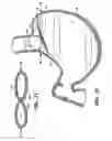 Fig. 07 - Methods and devices for maintaining a space occupying device in a relatively fixed location within a stomach
