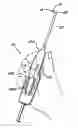 Fig. 01 - Reciprocating apparatus and methods for removal of intervertebral disc tissues