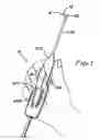 Fig. 02 - Reciprocating apparatus and methods for removal of intervertebral disc tissues