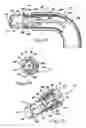 Fig. 06 - Reciprocating apparatus and methods for removal of intervertebral disc tissues