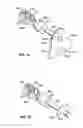 Fig. 22 - Method and inflatable chamber apparatus for separating layers of tissue