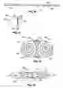 Fig. 33 - Method and inflatable chamber apparatus for separating layers of tissue