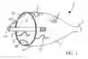 Fig. 02 - Embolic protection system