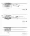 Fig. 05 - Embolic protection system