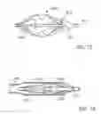 Fig. 20 - Embolic protection system