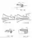 Fig. 34 - Embolic protection system