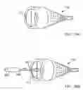 Fig. 44 - Embolic protection system