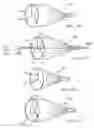 Fig. 45 - Embolic protection system