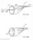 Fig. 47 - Embolic protection system