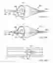 Fig. 48 - Embolic protection system