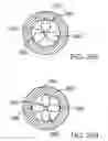 Fig. 68 - Embolic protection system