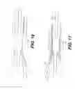 Fig. 09 - EMBOLIC PROTECTION DEVICE