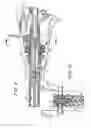Fig. 07 - Articulating endoscopic surgical apparatus