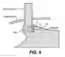 Fig. 06 - Devices and related methods for securing a tissue fold