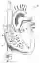 Fig. 01 - Signal delivery through the right ventricular septum