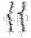 Fig. 06 - Signal delivery through the right ventricular septum