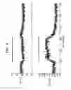 Fig. 07 - Signal delivery through the right ventricular septum