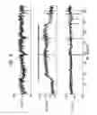 Fig. 08 - Signal delivery through the right ventricular septum