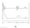 Fig. 02 - Method and apparatus for optimization of cardiac resynchronization therapy using heart sounds