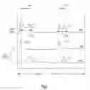 Fig. 04 - Method and apparatus for optimization of cardiac resynchronization therapy using heart sounds