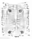 Fig. 16 - Method, apparatus, surgical technique, and stimulation parameters for autonomic neuromodulation for the treatment of obesity