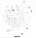 Fig. 20 - Method, apparatus, surgical technique, and stimulation parameters for autonomic neuromodulation for the treatment of obesity