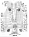 Fig. 31 - Method, apparatus, surgical technique, and stimulation parameters for autonomic neuromodulation for the treatment of obesity