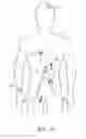 Fig. 08 - Body attachable unit in wireless communication with implantable devices