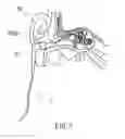 Fig. 08 - LASER ACTIVATOR FOR PHYSICAL TREATMENT