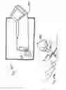 Fig. 32 - Micro vein enhancer