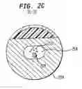 Fig. 05 - Prosthetic hearing implant electrode assembly having optimal length for atraumatic implantation